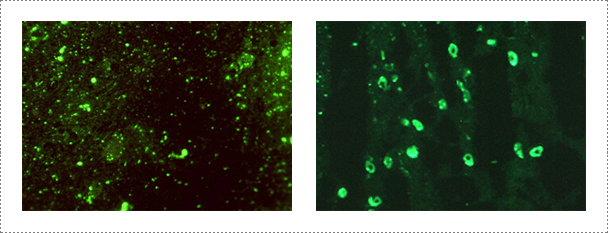 Fig. 1. Detection of rabies virus by indirect fluorescent antibody test in infected brain samples (Journal of Veterinary Science, Yang DK et al., 2012).