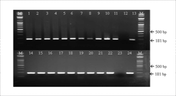 Fig. 5. Detection of rabies virus (RABV) by RT-PCR assay. A common type PCR primer set (product size of 181 bp) was designed to detect all RABV. The rabies laboratory routinely conducts RT-PCR assay for rapid detection of virulent RABV (Journal of Veterinary Science, Yang DK et al, 2012).