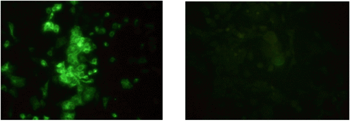 Fig. 2 Immunofluorescence staining of infected cells with JEV. Fluorescence was found in the cytoplasm. (Journal of Veterinary Science, Yang DK etal.2004).