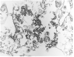 Fig. 3 JEV particles in cytoplasm of Vero cell infected with KV1899 strain. (J Vet Sci, Yang DK et. al, 2004).