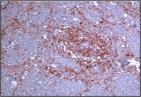 BSE 감염 소 뇌 조직 내에 변형 프리온 검사(면역조직화학염색; IHC) 이미지