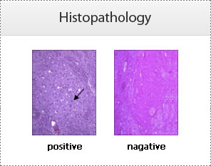 Histopathology