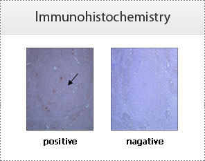 lmmunohistochemistry