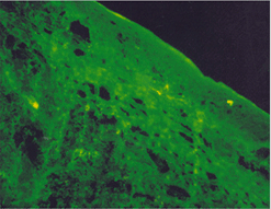 사진32) 편도의 점막면 중층편평상피 세포의 세포질 주위에 약한 녹색의 비특이 반응 이미지