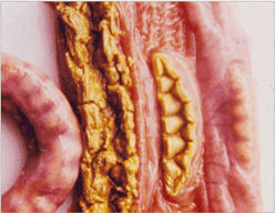 사진44) 살모넬라에 감염된 돼지 결장. 점막에 황갈색의 거친 막편이 부착됨 이미지