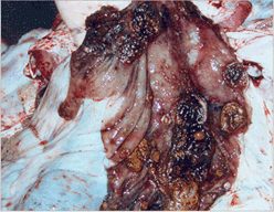 사진45) 살모넬라에 감염된 돼지 맹장. 점막에 황갈색의 버튼양 궤양이 관찰됨 이미지