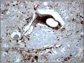 BSE 감염 소 뇌 조직 내에 변형 프리온 검사(면역조직화학염색; IHC) 이미지