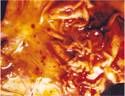 사진15) 돼지열병에 감염된 돼지의 위점막에 다수의 암적색 반점 이미지