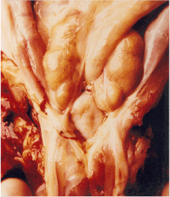 사진47) 돼지이유후전신소모성증후군(PMWS)에 감염된 돼지. 얕은샅림프절의 심한 종대 이미지