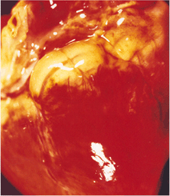 사진59) 상실심장병(Mulberry heart disease)에 감염된 돼지 심장의 출혈 이미지