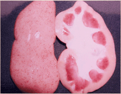사진60) 상실심장병에 감염된 돼지 신장 표면에 자적색 반점들이 다수 관찰됨 이미지