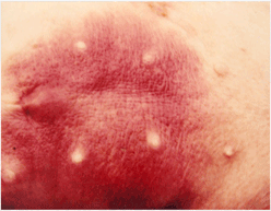 사진62) 전신성 연쇄상구균 감염증을 보인 돼지. 복부 피부가 암적색으로 발적 이미지