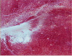 사진64) 톡소플라스마에 감염된 돼지의 간. 표면에 회백색 반점이 관찰됨 이미지