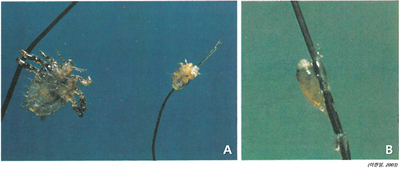 그림 4-5. 사면발이 성충과 약충(A); 서캐(B)